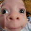 catapimbas20